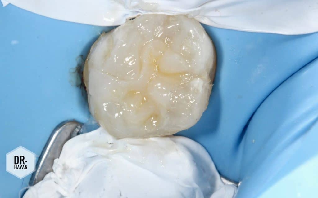 C3ADD5E1-40C7-4414-9AB6-3989E859AC35