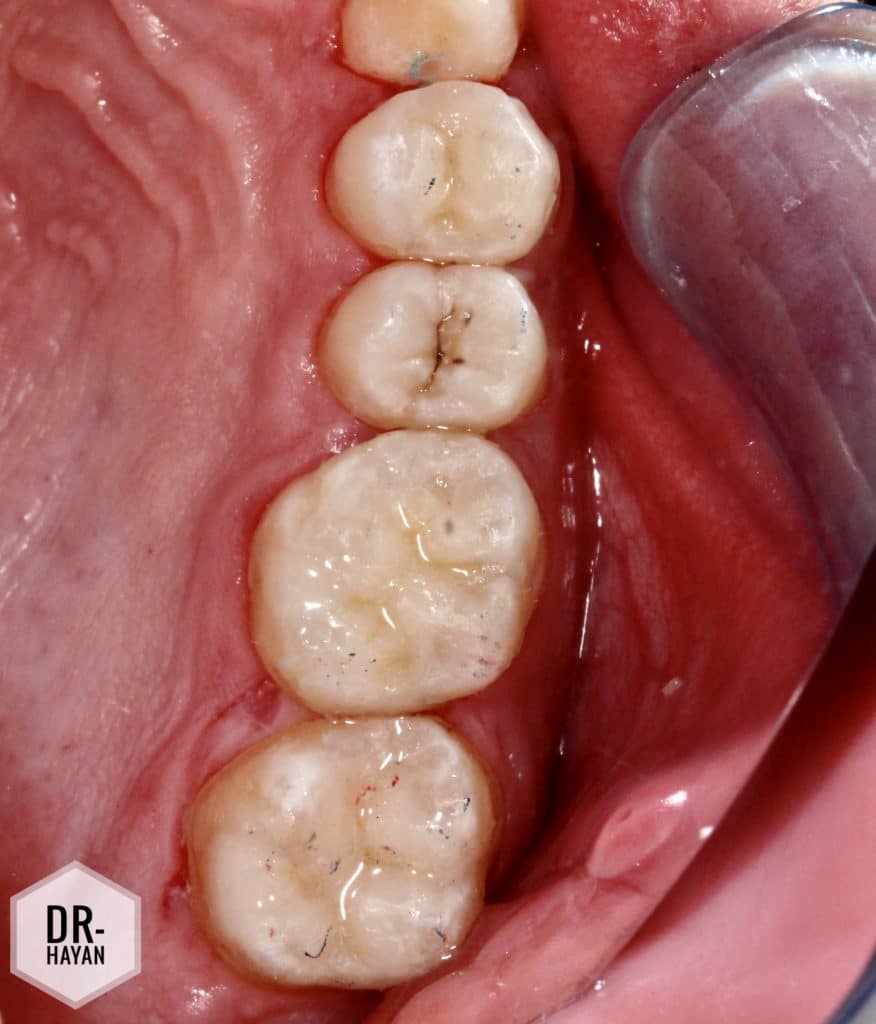 CD937245-D603-4A41-BDF9-225753C03065