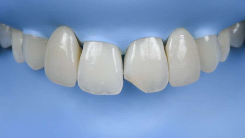 D1A01667-A010-4E06-BB0C-8B2154EAB419