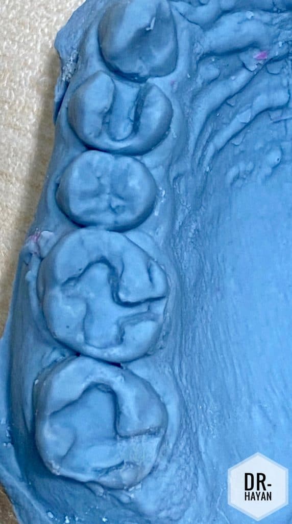 D3377433-267D-45D5-A754-55ACE1E0C3D2