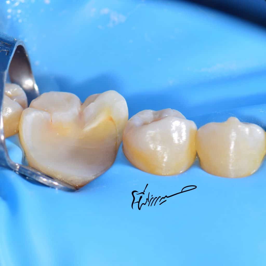 D3660F5F-FAD8-4EE5-9369-58011041D594