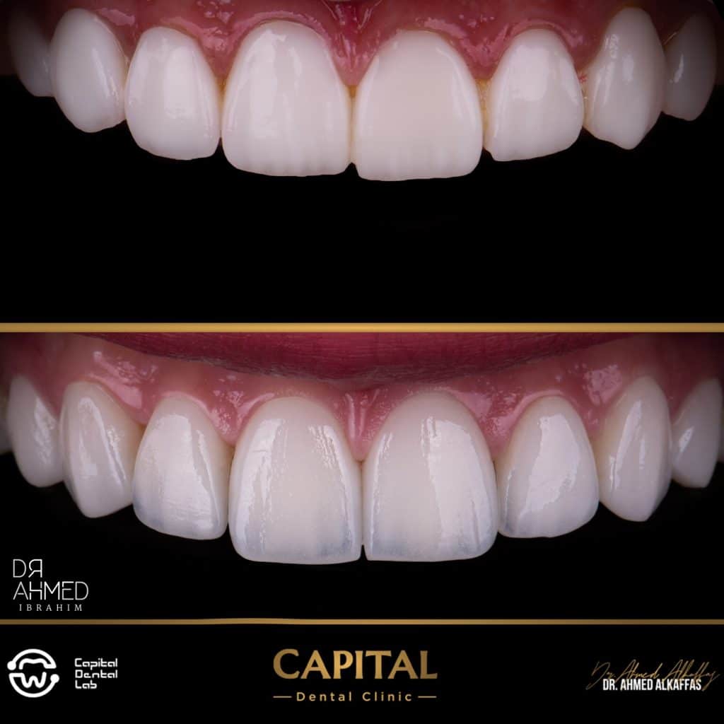 Initial situation vs final results