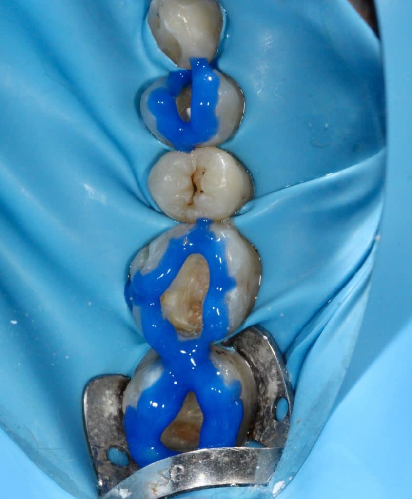 D67DBF11-8BFE-4891-A751-D965A1FDEC9B