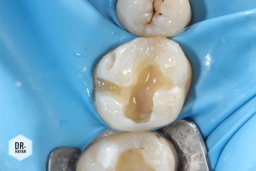 D809AA98-5ED2-4DD2-B83E-FF646DB3A1CF