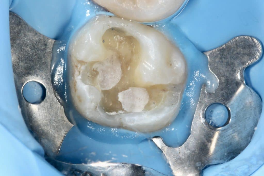 E27FF11B-3BE2-47EB-A81E-2FC35495E94D