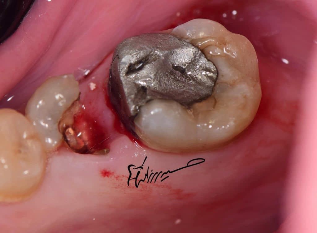 E2BD5D36-B85A-40FE-9B38-C0DE09772828