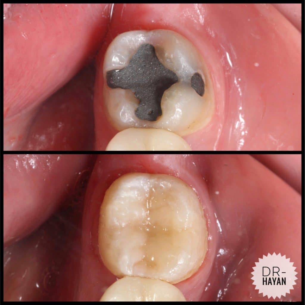 E7677D43-1EB3-4656-BFD9-487C03232643