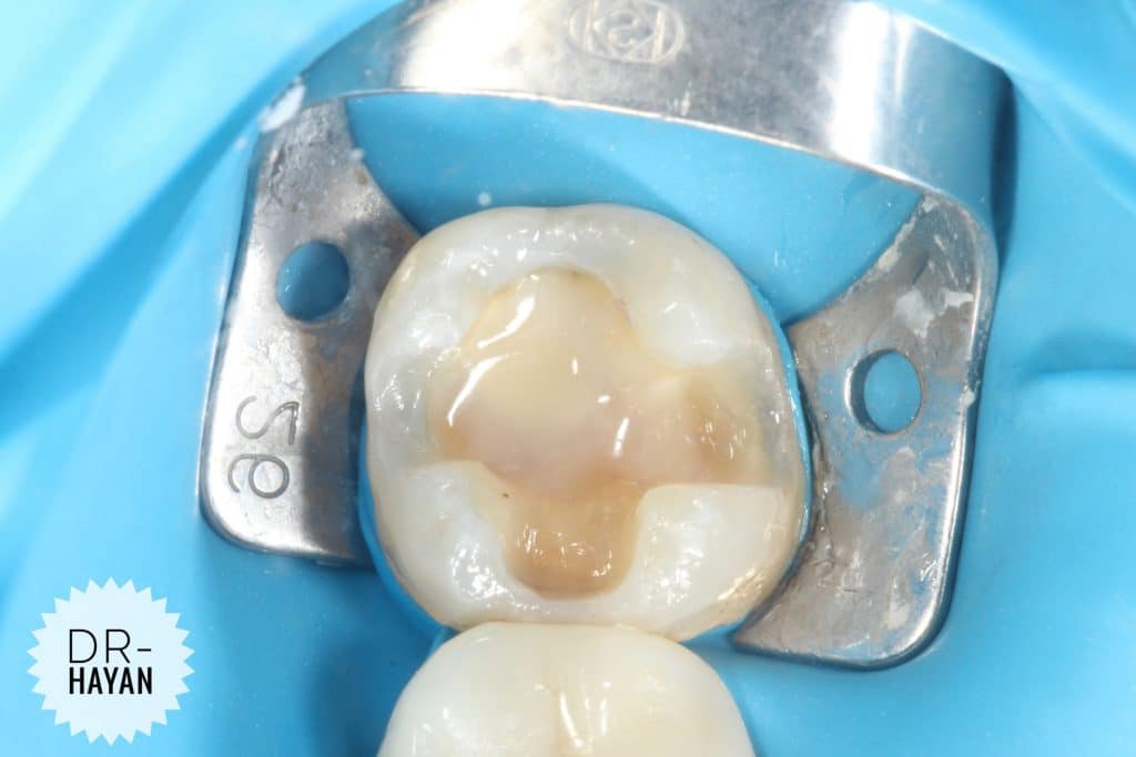 EC66E86D-FDB9-49FB-9E06-7AA77500DC61