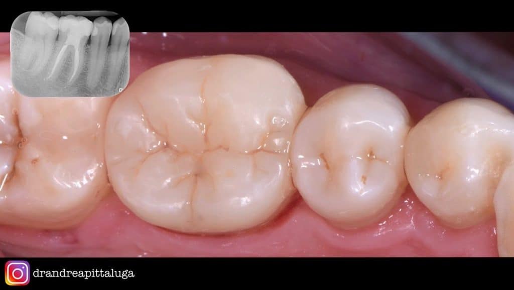 F3036292-FD18-4763-A0CE-453BFD4A3C0F