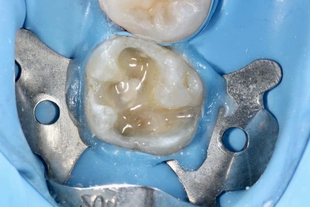 F3BCEE17-9E49-4291-89AA-DDC71AE89D17