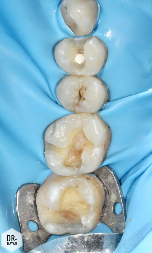 F41F3D99-65E9-48C0-B4EE-6698F792AAAC