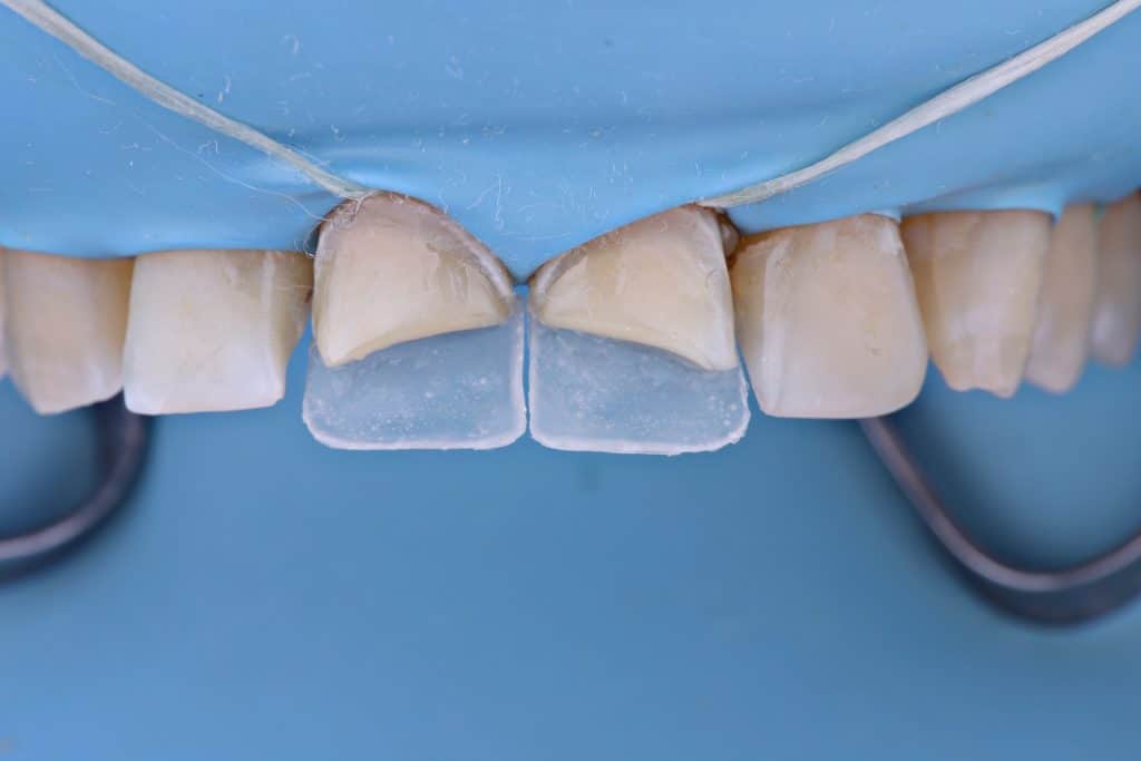 F645E45B-F71C-4326-AED9-25AB7C40BA14