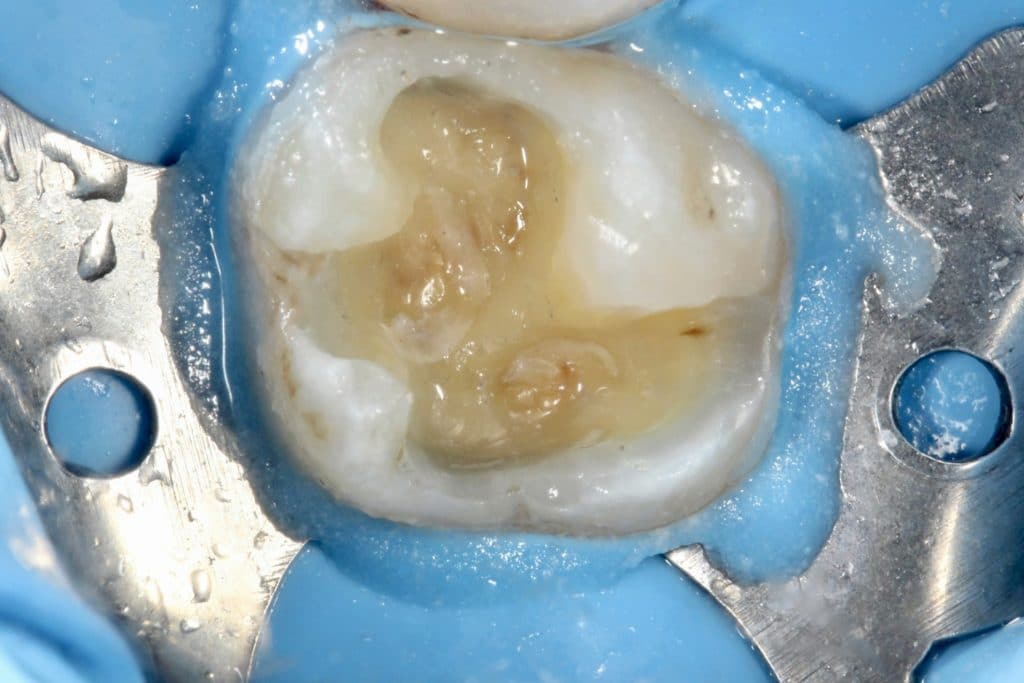 F83934A7-E6D0-455A-A3CC-EBB078F3C0DB