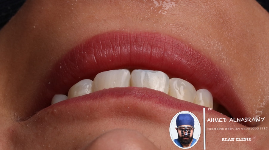 F850EBAC-D110-4697-BD68-D1158899875A