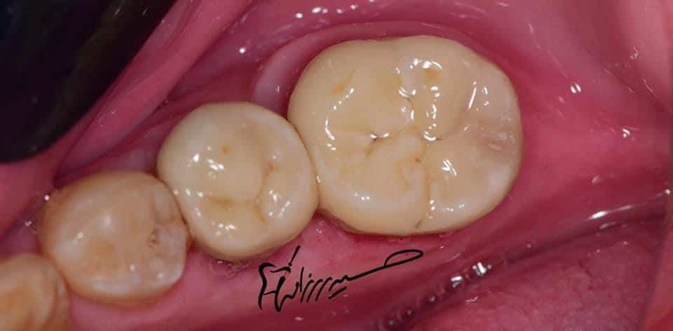 F9725CD6-AB43-4B6A-AD7D-9519F1878200