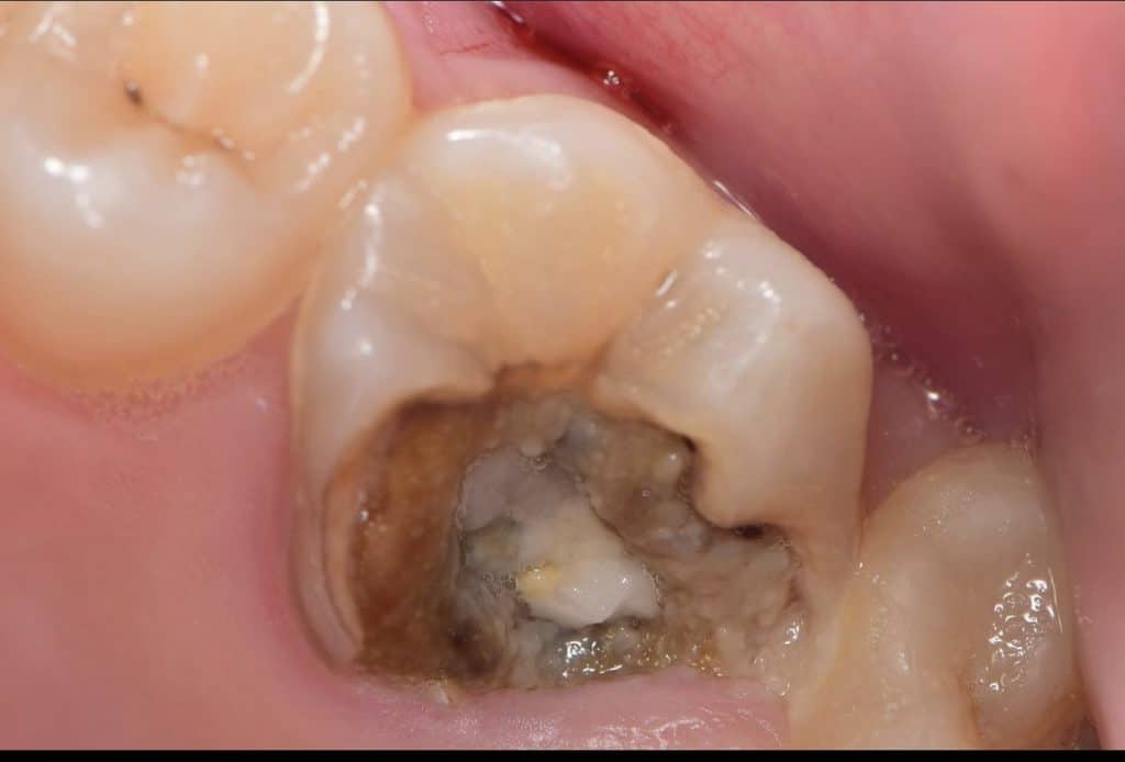 FB4A2828-979B-4073-A60C-2E276B919454