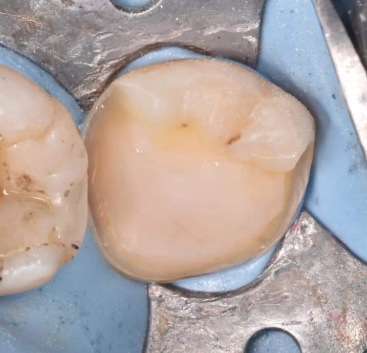 FB_IMG_1650411395504