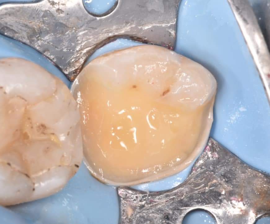 FB_IMG_1650414979563