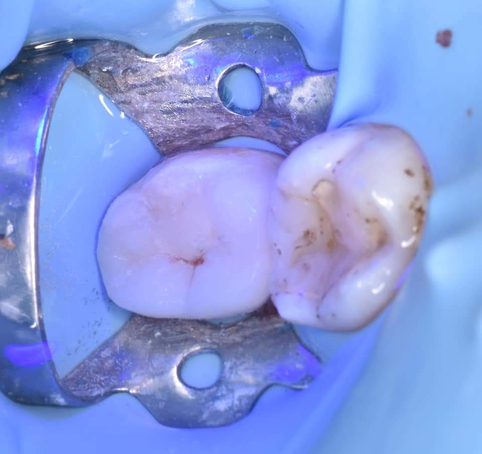 FB_IMG_1650414985836