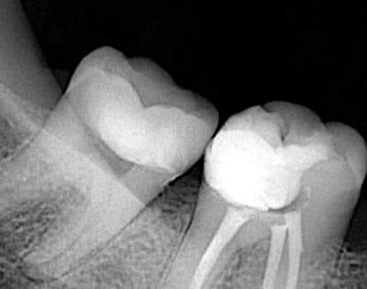 FB_IMG_1650415371860