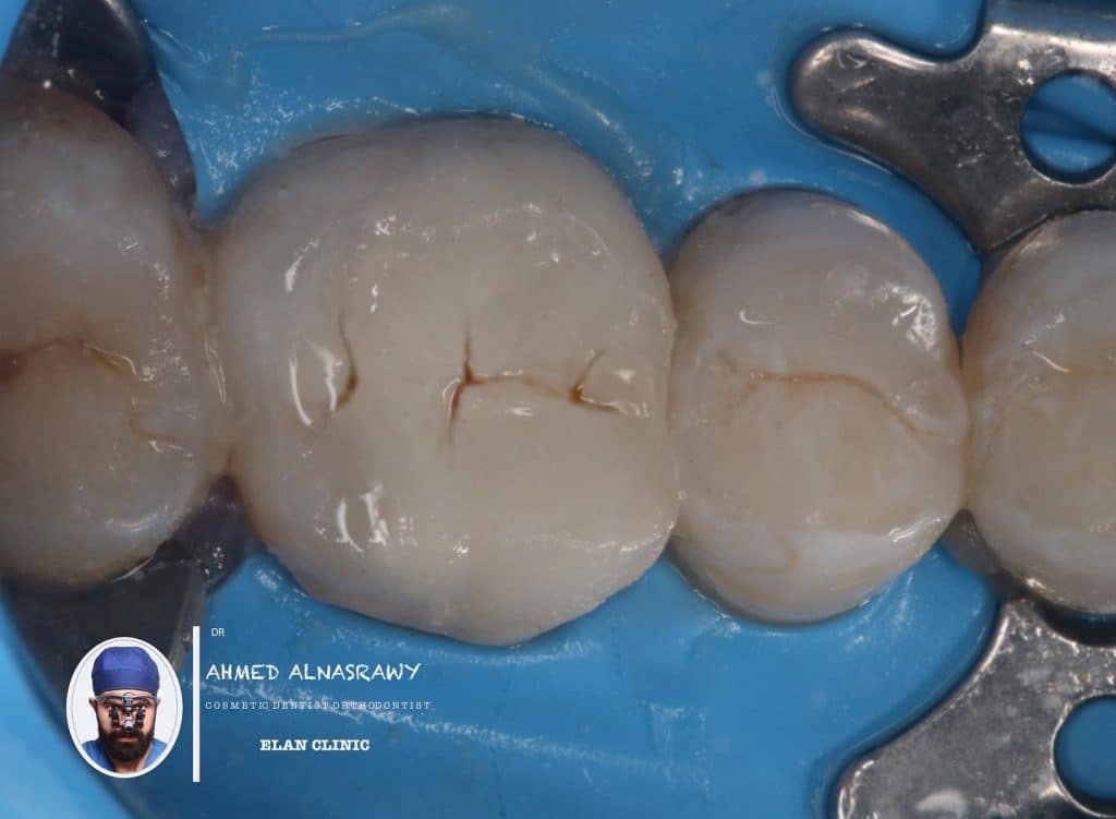 FC4ABD58-4787-4C3D-8AA0-C34BFA851BDD