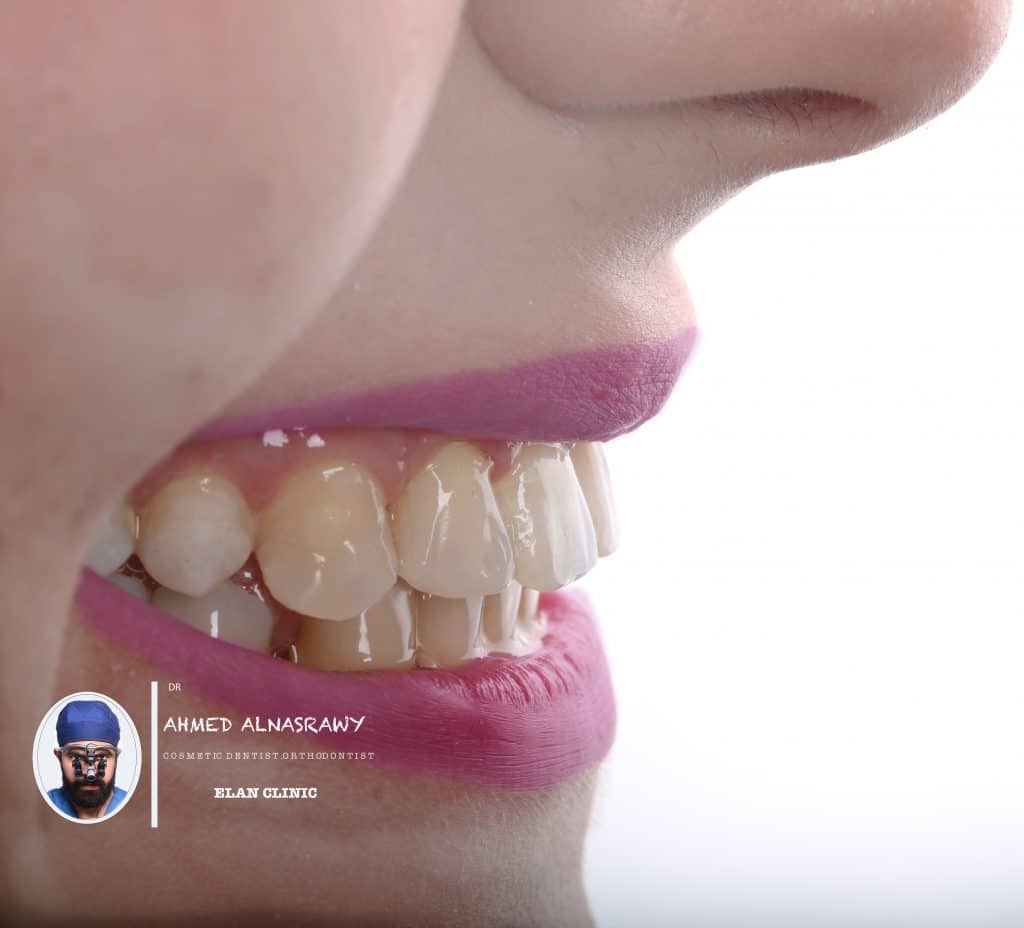 FF3C2627-D249-40F9-833D-B8EF814C3C96