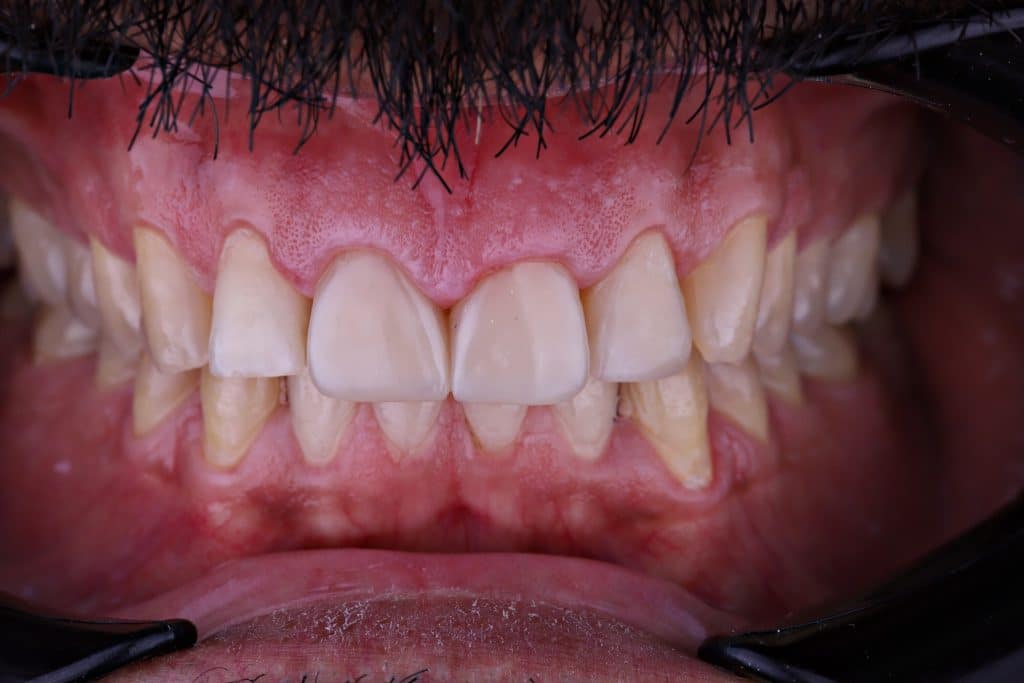 FF43618A-17DD-4407-99F3-E6416027D5C7