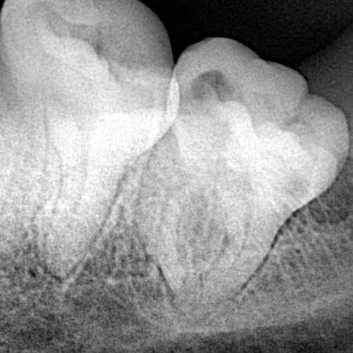 IMG_20220425_002425_366