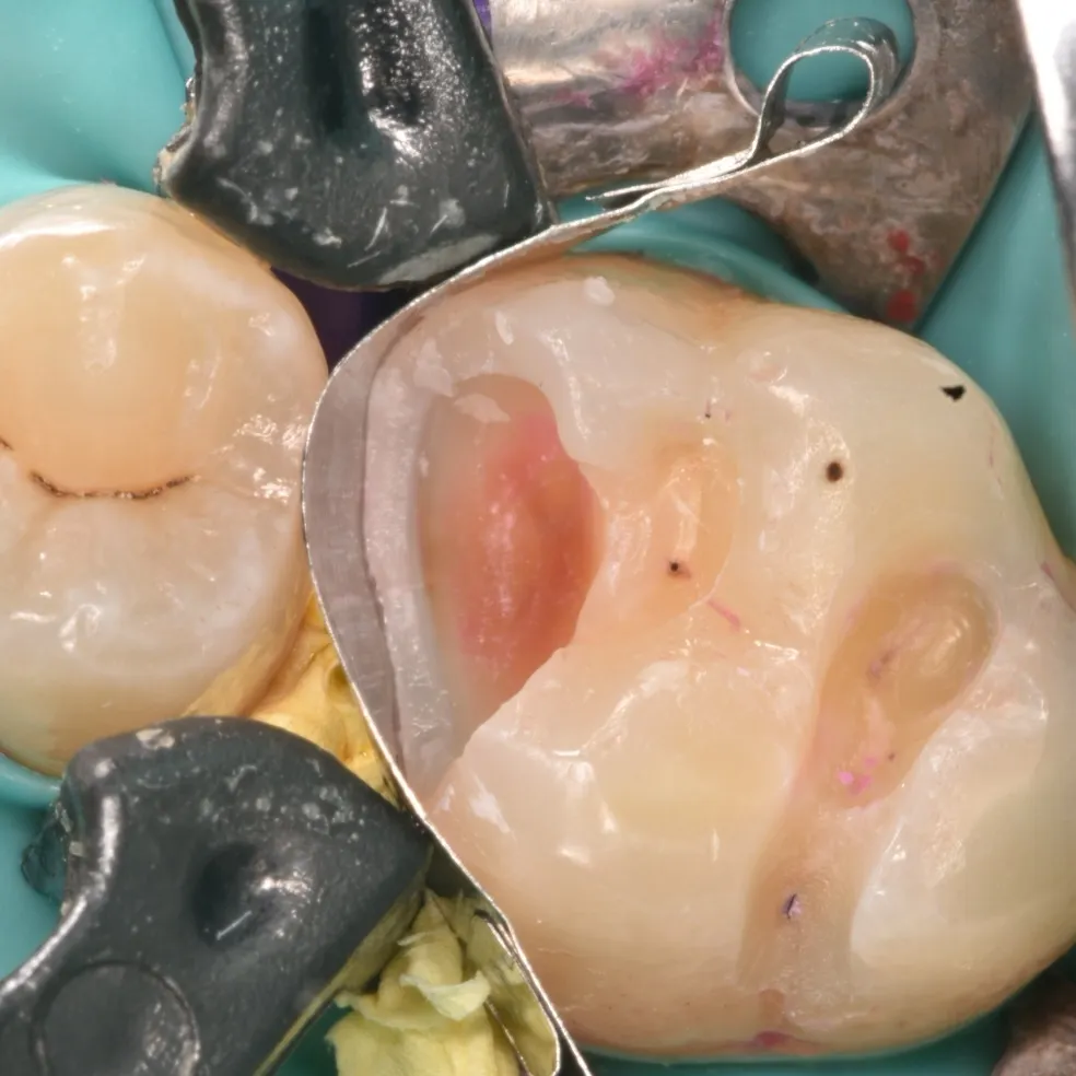 IMG_20220429_163300_874