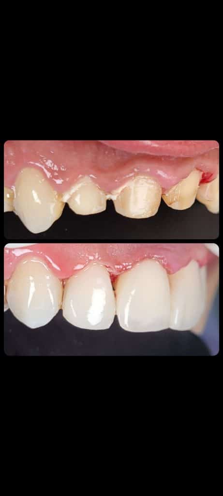 Screenshot_20220406-212736_Gallery