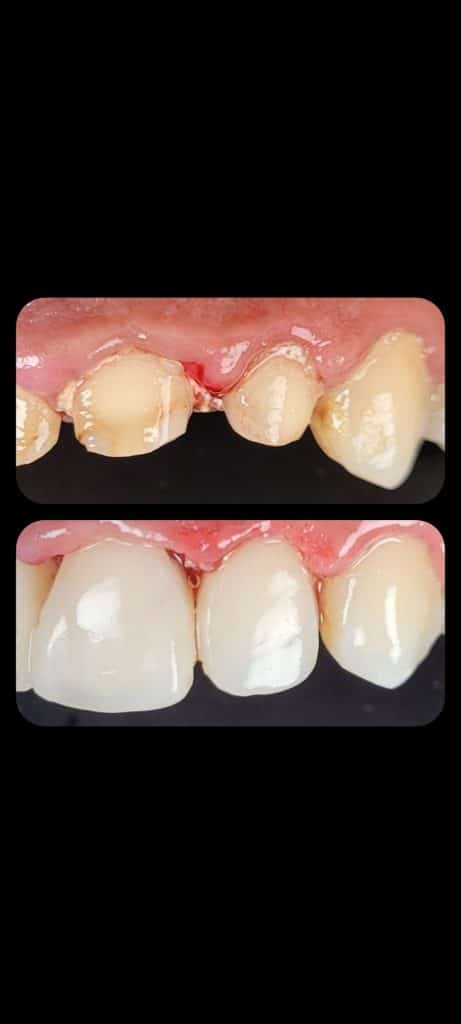 Screenshot_20220406-212745_Gallery