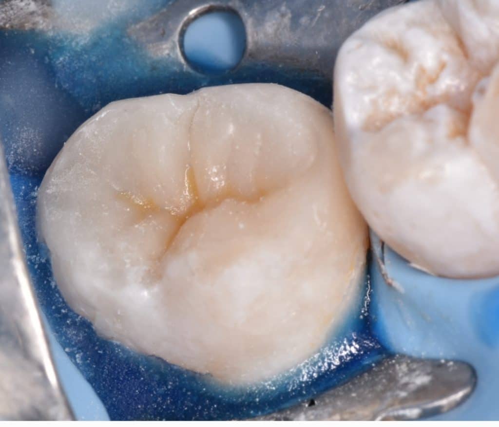 SmartSelect_٢٠٢٢٠٤١٦-١٤٤٥٥٥_Gallery