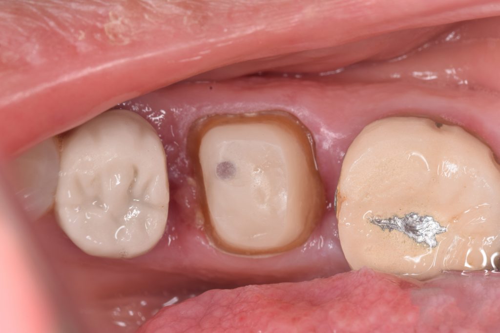 inbound3414908868555271905