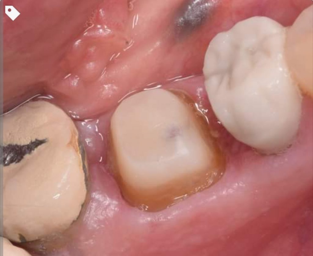 inbound7419806818055495297