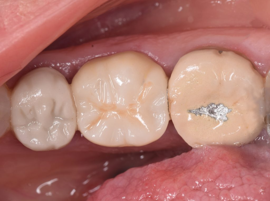 inbound7762495817074455985