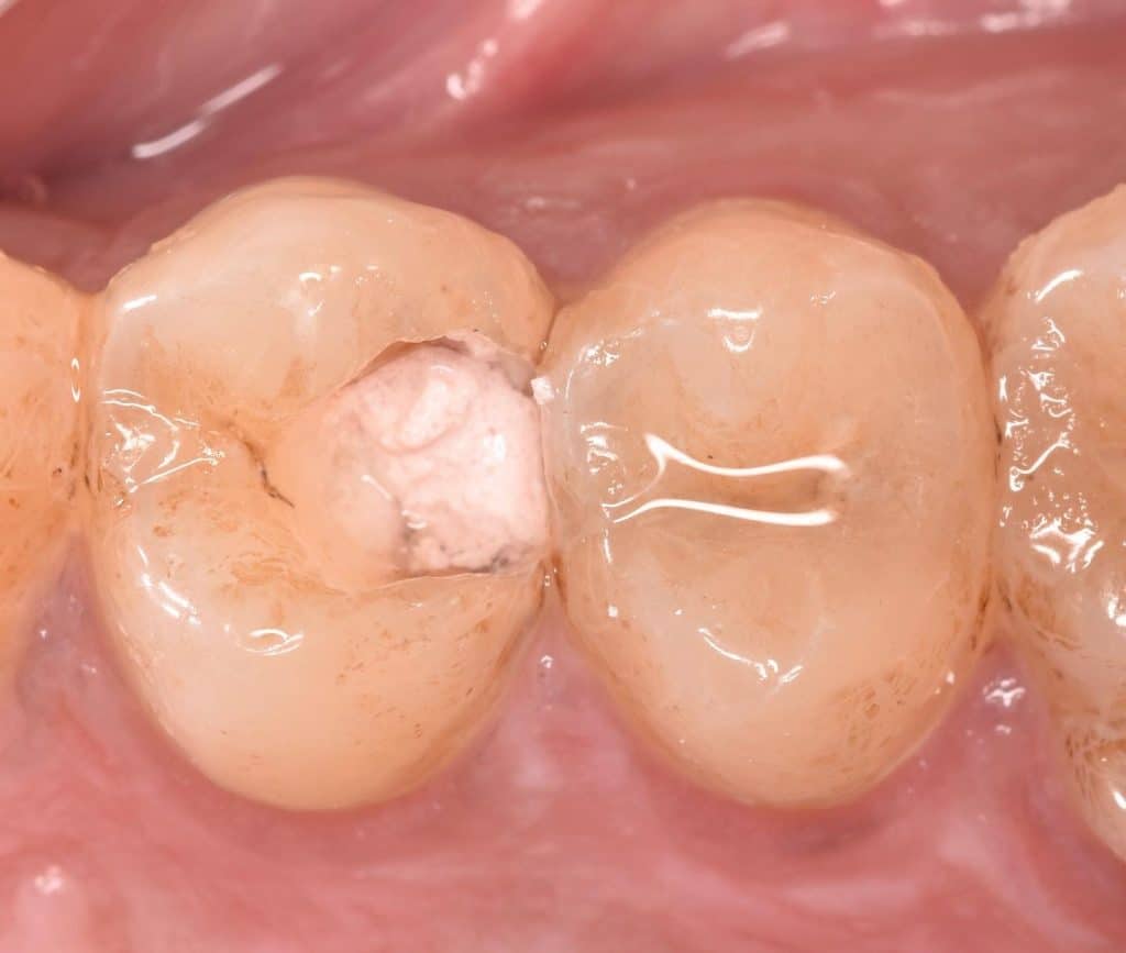 04DC9188-AA8E-4DDA-8377-4C530AD9CCA7