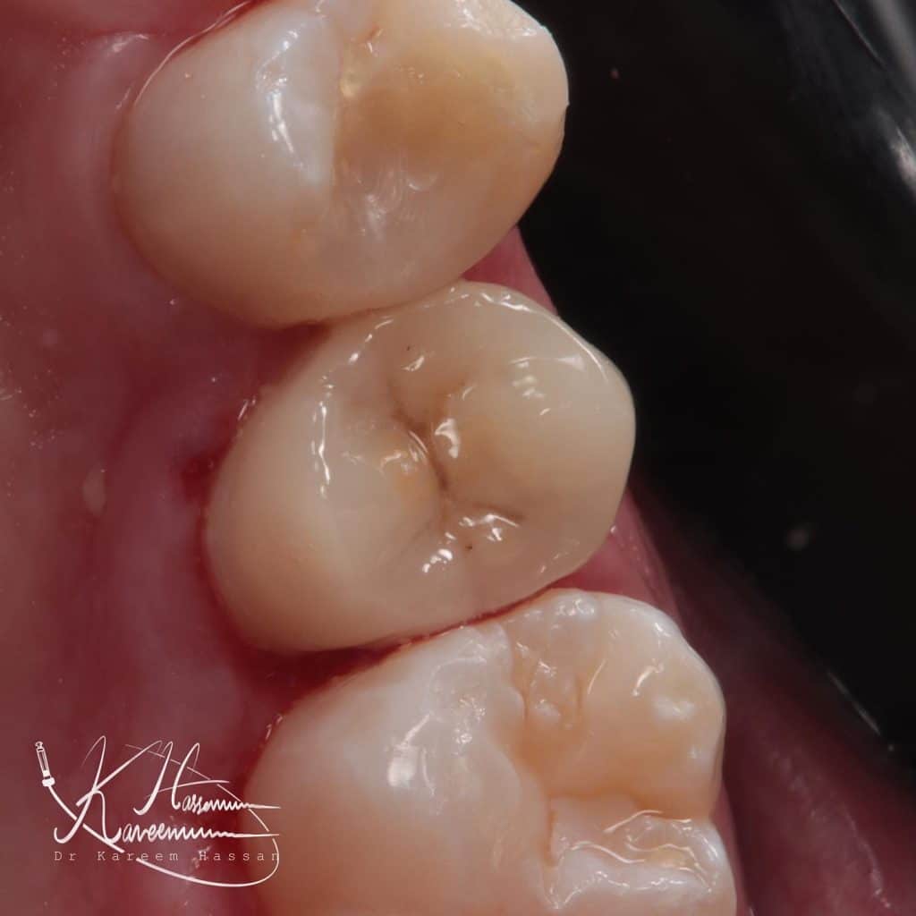 05008C70-7A30-4DAA-80B1-030CC799DACD