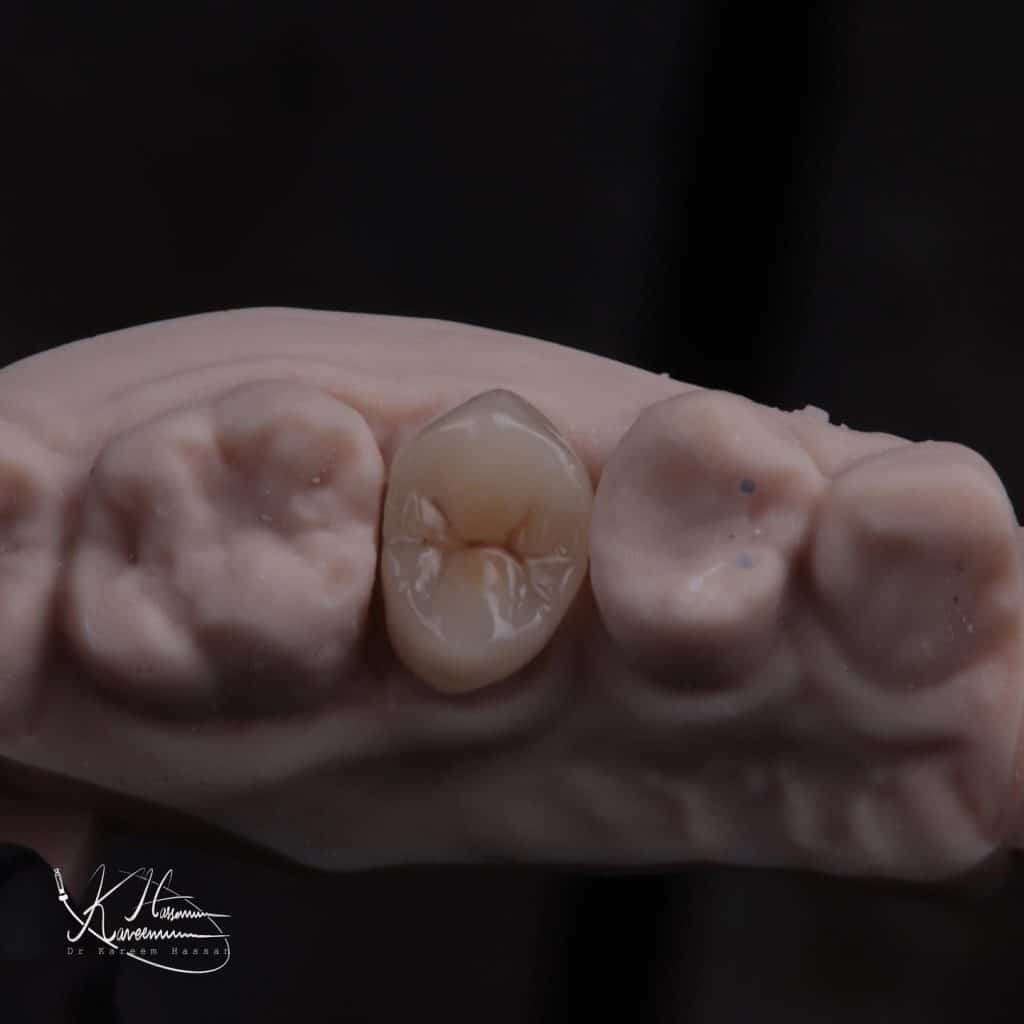 06B2DF89-CDC3-4D16-A63F-6D09F343647C