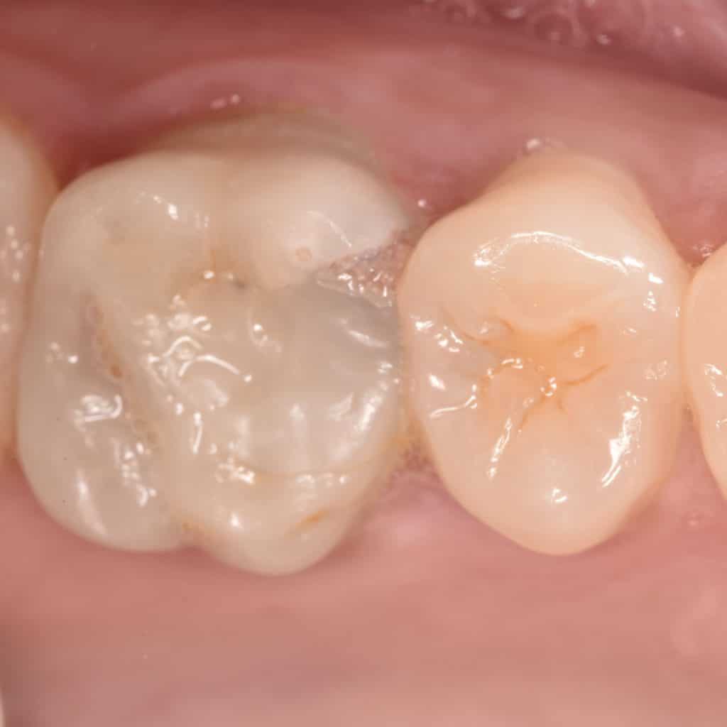 17DFF930-C307-4546-966D-F0F1C2ED719B