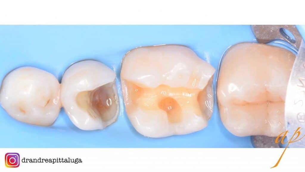 1F7A9CCE-7CC9-44BB-A7F6-84E06744E12A