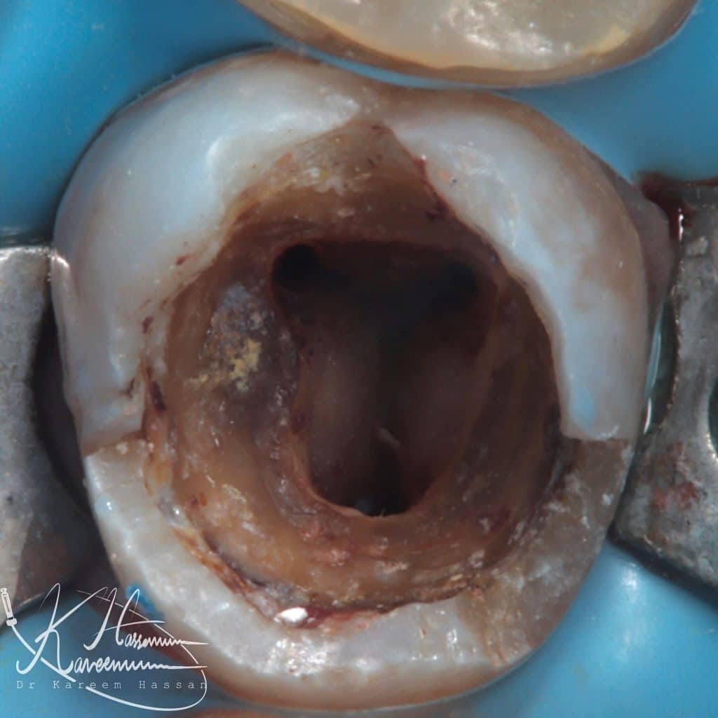 21312EAF-A68C-4153-8989-A2628BAE747A