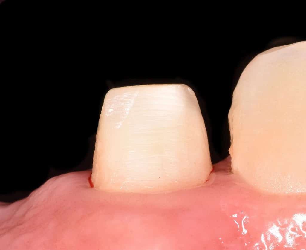 2536A0FF-6EFC-45AA-9DFA-047C44D7DFCD