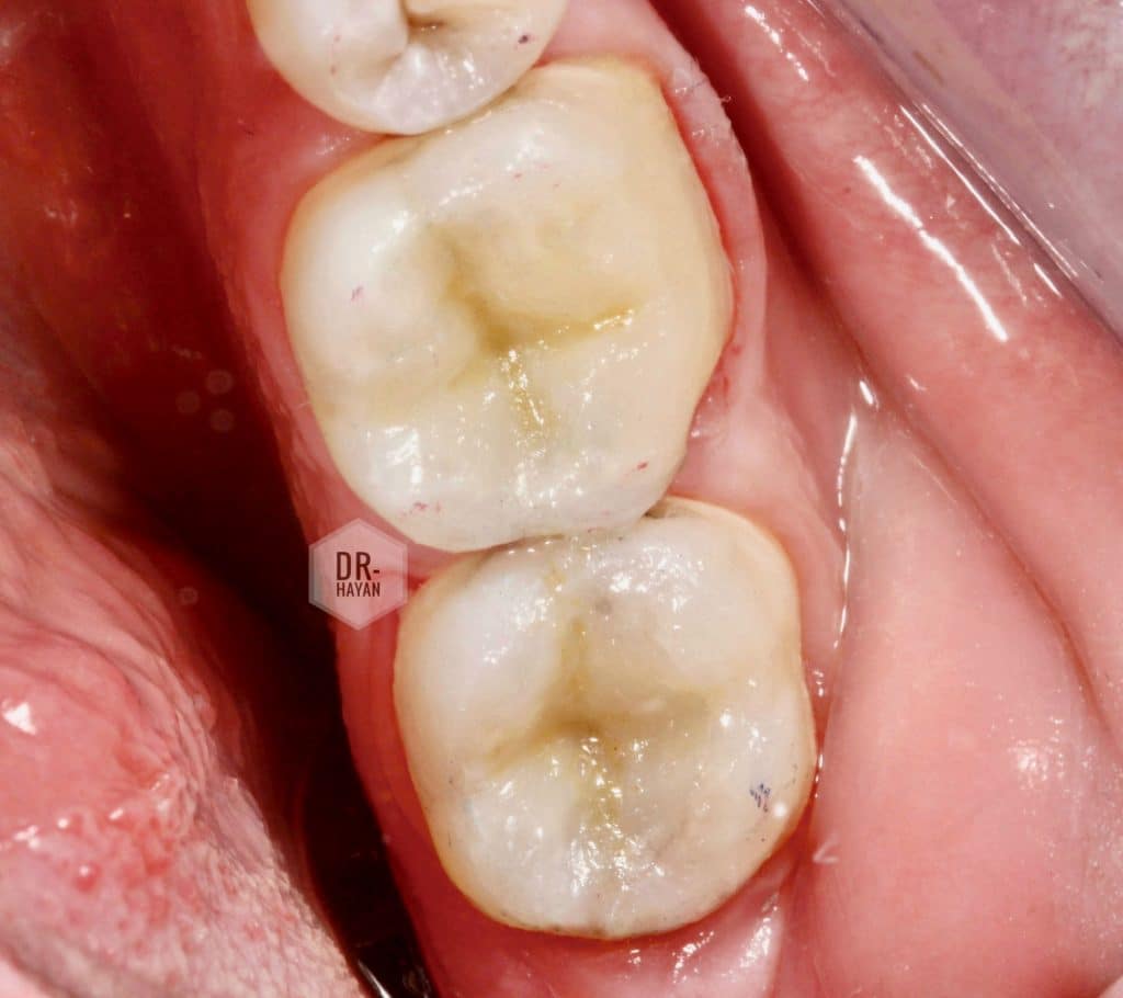 2E1A1A48-E916-45F2-9E41-65C21DA2F49C