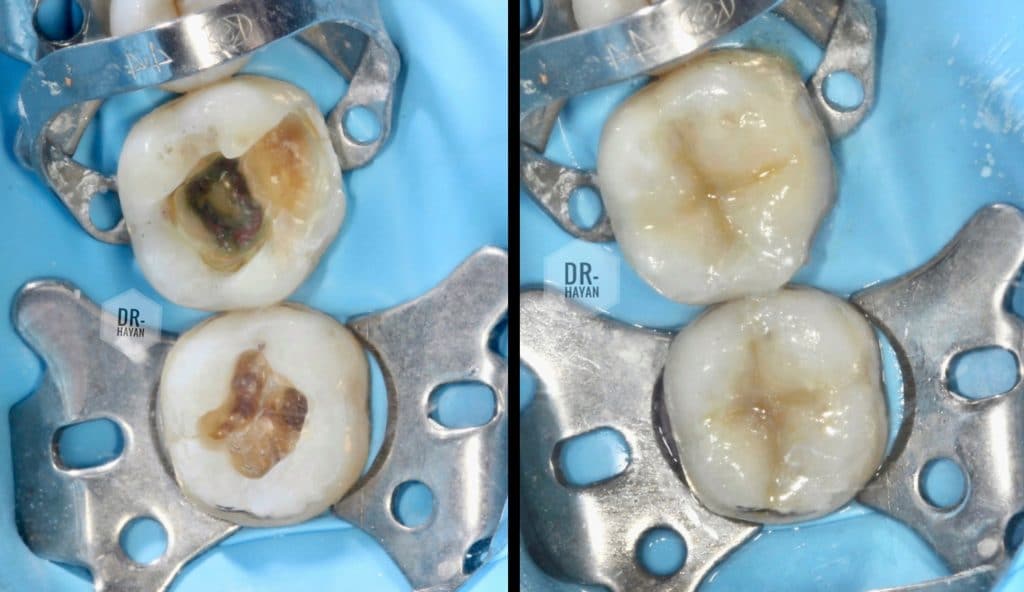 33FE8B03-FC36-4D90-A8C5-54762B834FC8