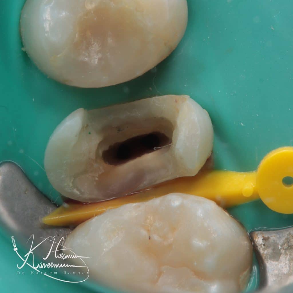 35F04559-9492-4F20-A9C0-CC277B61376F