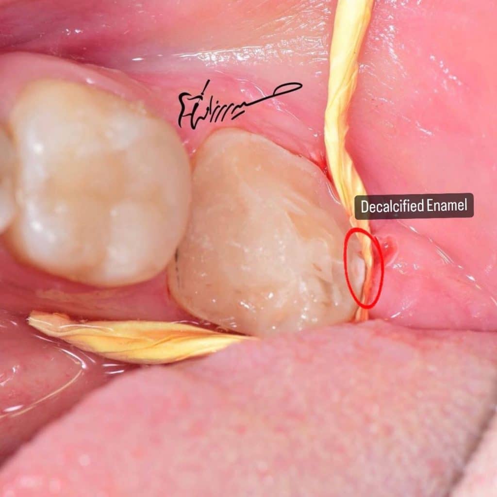 38CEB11A-5CBD-4A5C-A12B-4D8E61727F66