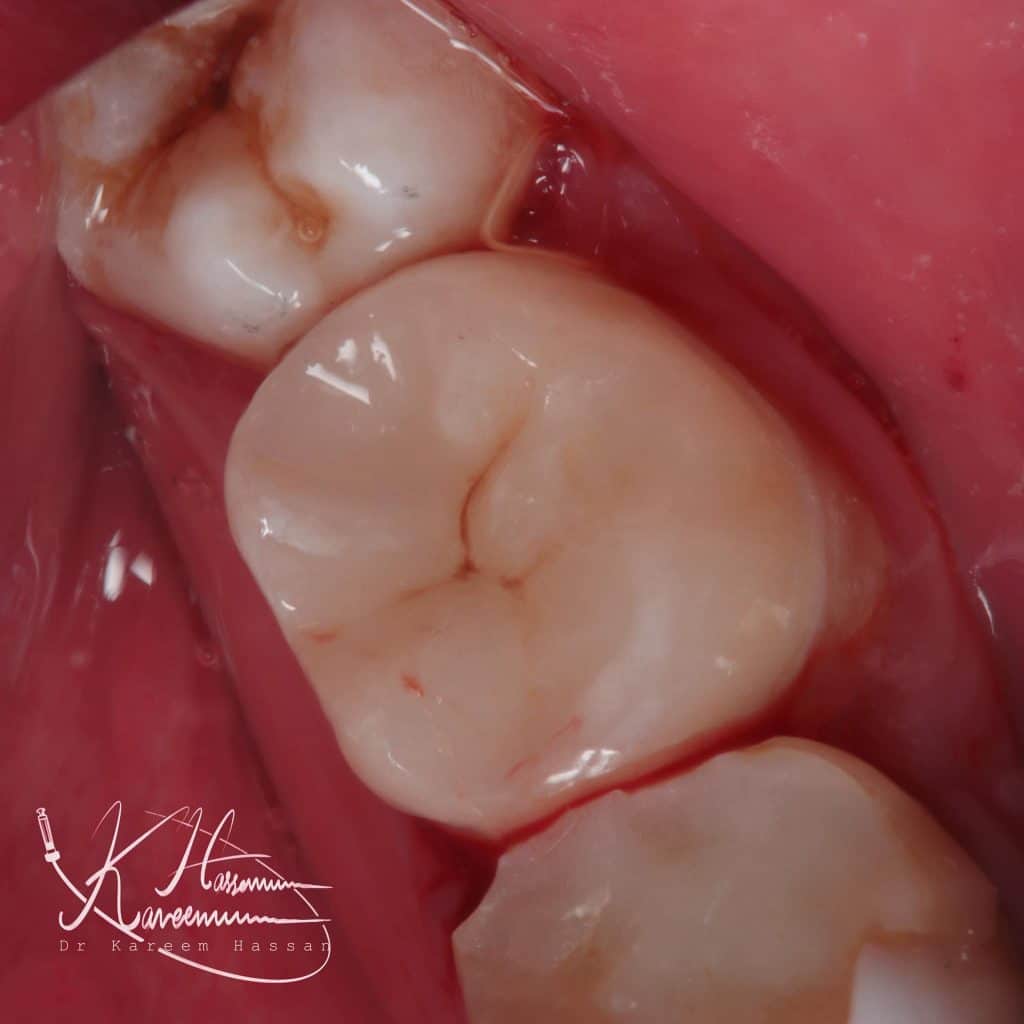 41EF906D-C014-4059-82A5-7C3827B8DE10