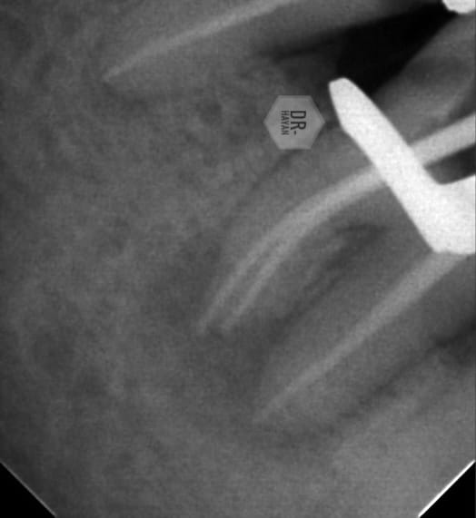 4ABCEFE1-0537-4394-95F1-E645B4D12D37