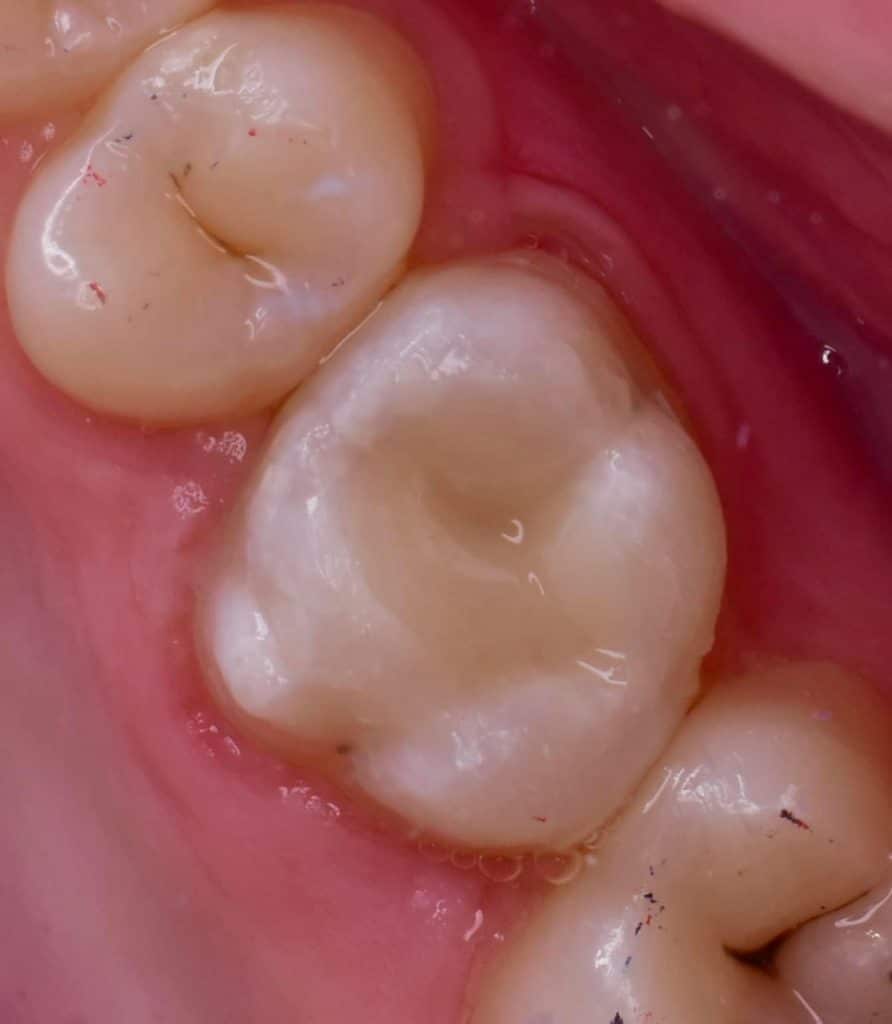 4B206E7F-2815-4FE1-95A9-B8341D001664