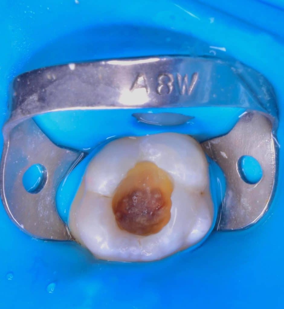 51525902-1214-4373-A204-179CCACAA081